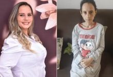 Mulher que chegou a pesar 36 quilos reverte bariátrica