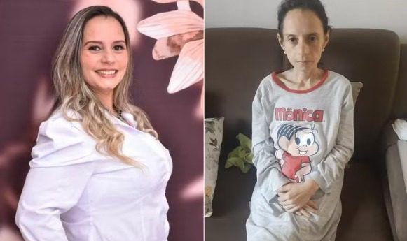 Mulher que chegou a pesar 36 quilos reverte bariátrica